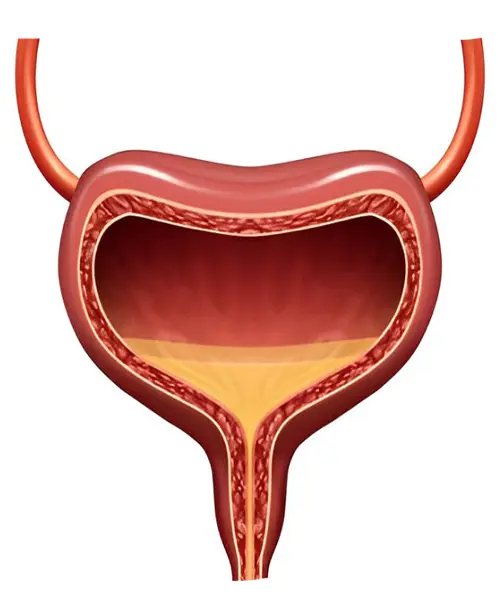 Overactive Bladder