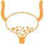 Bladder Stones